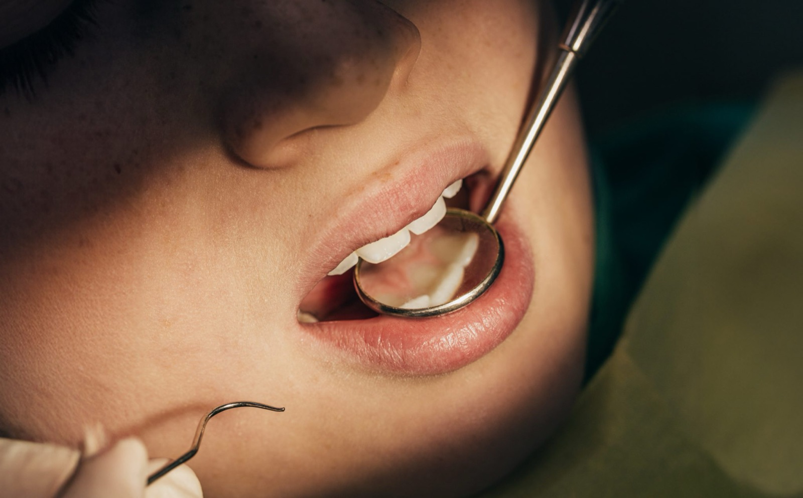 Costa mediterránea — formación MDEI en España e Italia